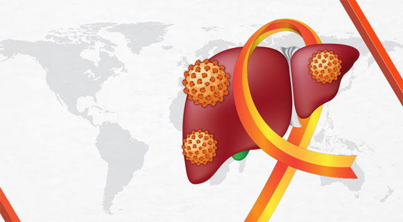 hepatitis